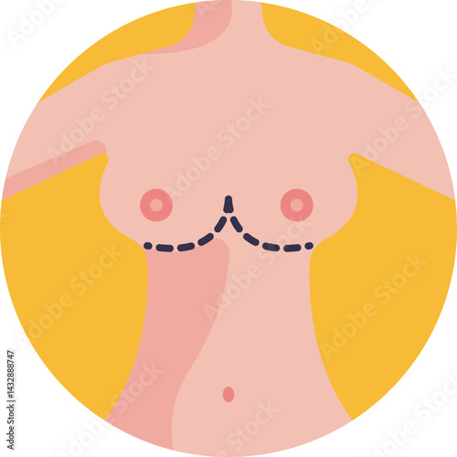 Breast Augmentation Surgery: A procedure to increase breast size using implants or fat transfer.