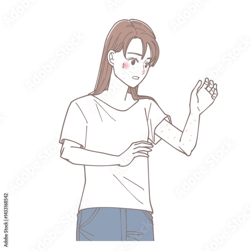 腕に湿疹が出てしまった女性のイラスト