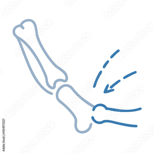 Elbow joint bone structure with arthritis indication