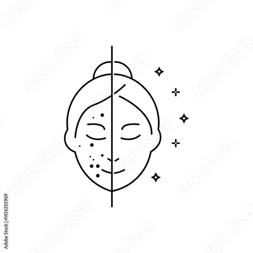 Woman with Acne and Clean Face Skin Line Icon. Girl Before and After Skin Treatment Linear Pictogram. Female Skincare for Cleansing Face Outline Icon.