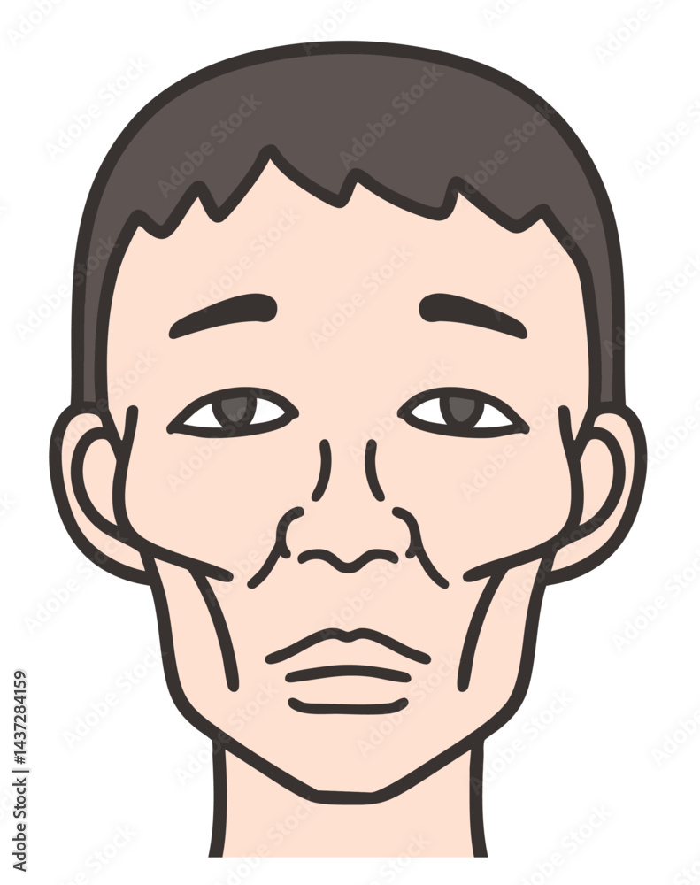 痩せこけた男性の顔 痩せこけた男性の顔