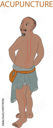 Chinese medicine, man with accupuncture lines on body vector illustration. Chinese art of healing, needles accupuncture.