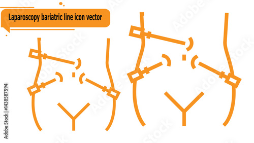 Laparoscopy bariatric line icon vector