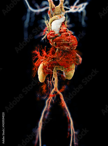 CTA Whole Aorta 3D showcases the aortic artery and its branches, offering a detailed look at the vascular.