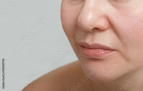 Close-up of Middle-Aged Woman with Deep Nasolabial Folds, Skin Aging Concept