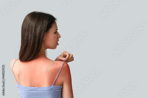 Young woman with red sunbur...