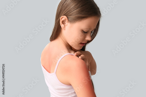 Little girl with red sunburned skin on grey background
