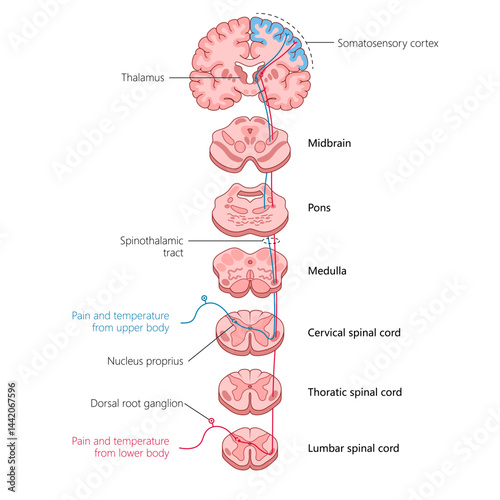 tracing the spinothalamic tract, showing how pain and temperature signals travel from the body through the spinal cord to the brain diagram hand drawn schematic vector. Medical science educational