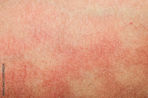 human skin texture