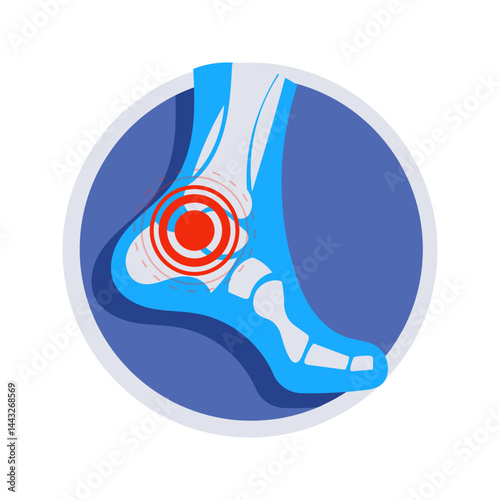 X ray showing ankle pain and inflammation inside a circle