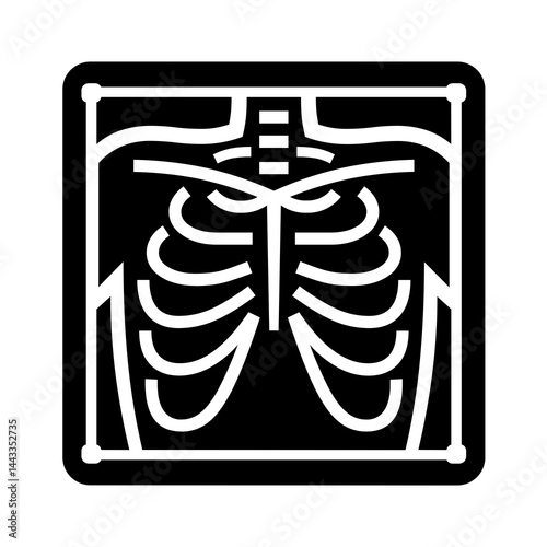 Medical X-Ray Image of a Chest