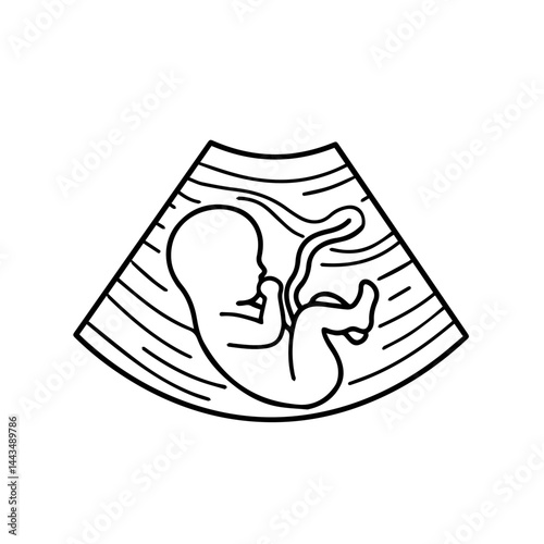 Ultrasound image of a fetus in the womb  
