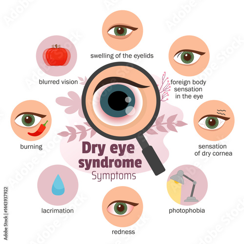 Vector medical poster symptoms of conjunctivitis.
