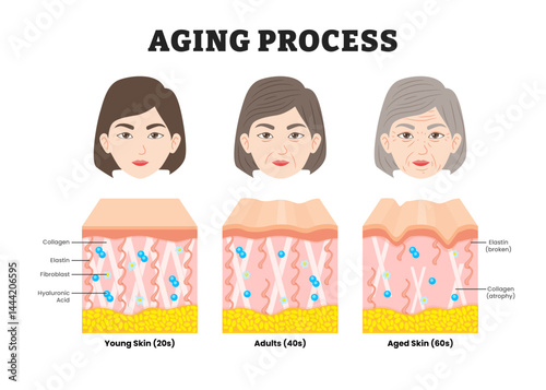 Aging process, educational medical poster design healthcare scheme, labeled comparison of Young, Adults and aged skin, Collagen, Elastin, Hyaluronic acid and fibroblasts. Face skin structure changes.