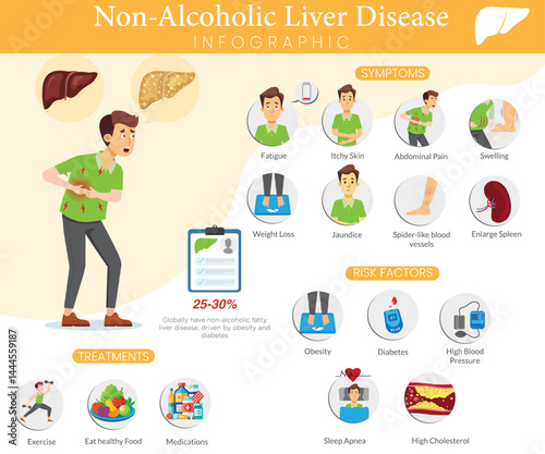 Nonalcoholic Liver Disease Infographic Showing Causes and Treatments
