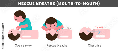 CPR . Cardiopulmonary resuscitation . Procedure of rescue breaths and mouth ot mouth . Flat design cartoon characters . Isolate white background . Vector .