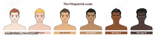 The Fitzpatrick skin tone phototype with men cartoon character illustration on white background. Diagram of ethnicity skin tone scale phototype melanin and hair color melanin. The Fitzpatrick scale.