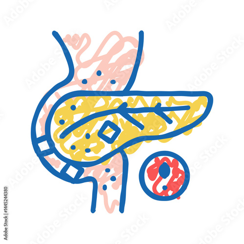 stones in pancreas icon doodle illustration