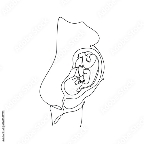 Continuous single line of baby fetus in mother womb. Human embryo with umbilical cord sketch drawing editable stroke vector illustration