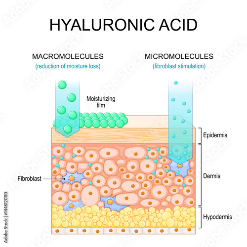 Hyaluronic acid.