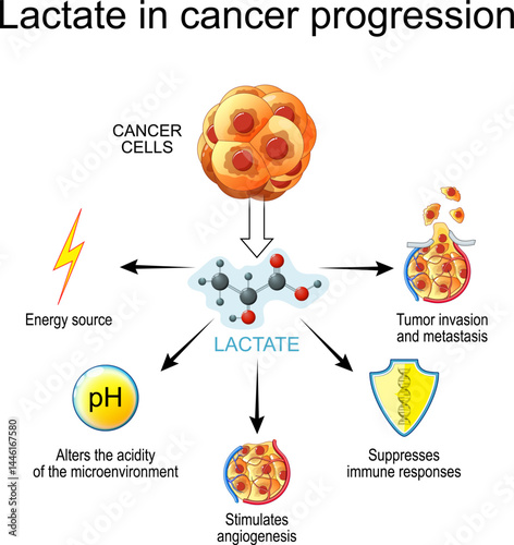 Tumor Development. Lactate in cancer progression. Oncogenesis