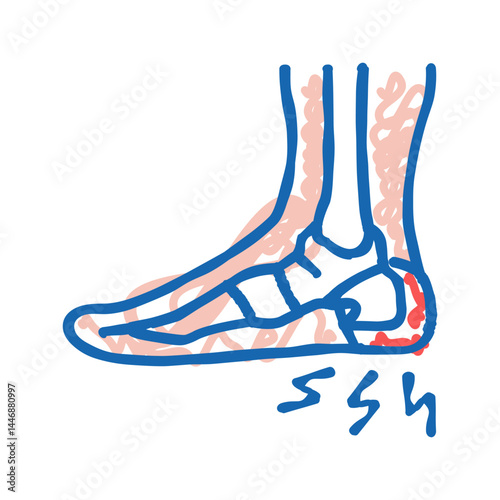 heel spur disease icon doodle illustration
