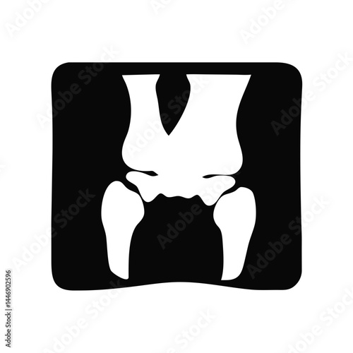 Medical XRay Image Showing Human Knee Joint Anatomy Bones Structure