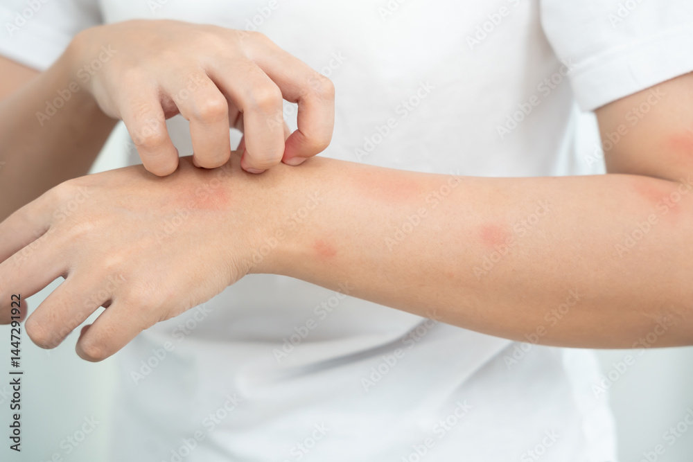 Skin and beauty problems: Women have itchy skin and red rashes from cosmetic allergies, steroid allergies, sensitive skin, redness from sunlight, chemical allergies, rashes, insect bites. Skin and beauty problems: Women have itchy skin and red rashes from cosmetic allergies, steroid allergies, sensitive skin, redness from sunlight, chemical allergies, rashes, insect bites.