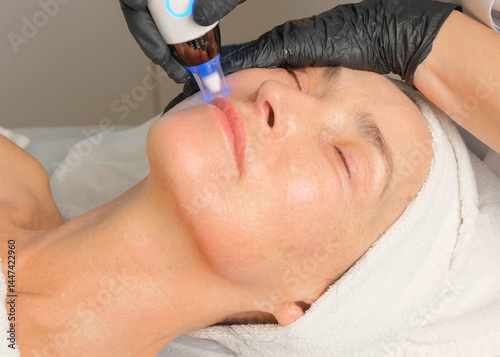 Close-up portrait of a beautiful aged woman during microneedling with dermapen from a beautician.