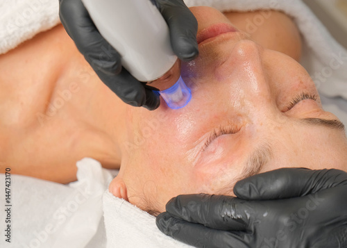 Close-up portrait of a beautiful aged woman during microneedling with dermapen from a beautician.