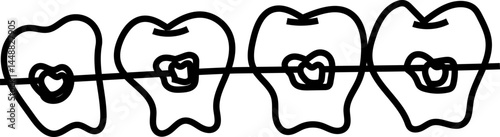 Braces and Tooth Alignment Illustration in Hand-Drawn Style