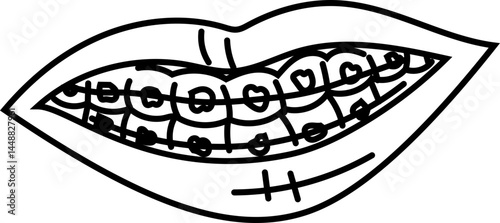 Braces Smile Vector Drawing in Cartoon Style