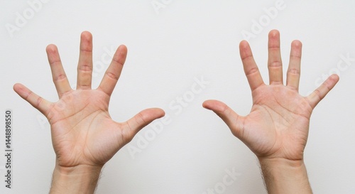 Two hands with fingers spread wide against a plain white background showing palms and wrists clearly