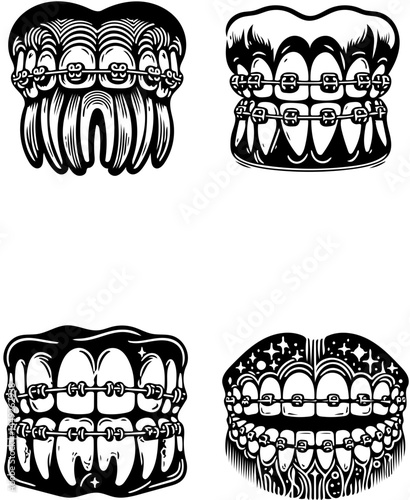 set of four different black and white vector illustrations showing teeth with orthodontic braces