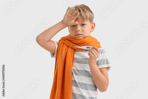 Little boy ill with chicken...