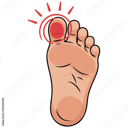Swollen stubbed toe injury isolated vector illustration on white background