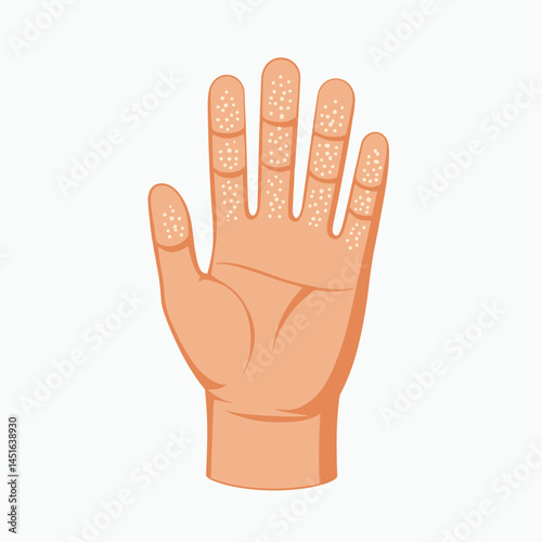 hand with multiple small bumps  healthcare concept illustration