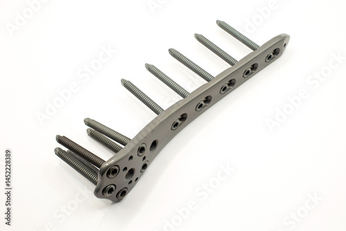 Distsl Femoral plate metal surgical implant with screws, designed for orthopedic use, showcasing precision photo