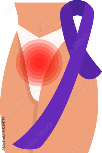 Gynecologic cancer awareness month. Gynecological disease illustration. Adnexal tumor