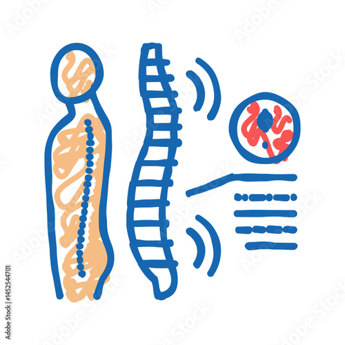 spondyloarthropathies health problem icon doodle illustration