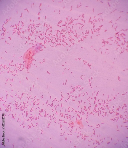 Cuadro en lienzo Gram stain of the bacteria E
