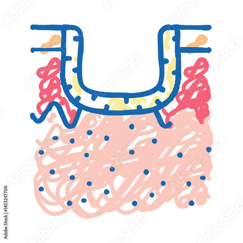 hypertrophic acne scar icon doodle illustration