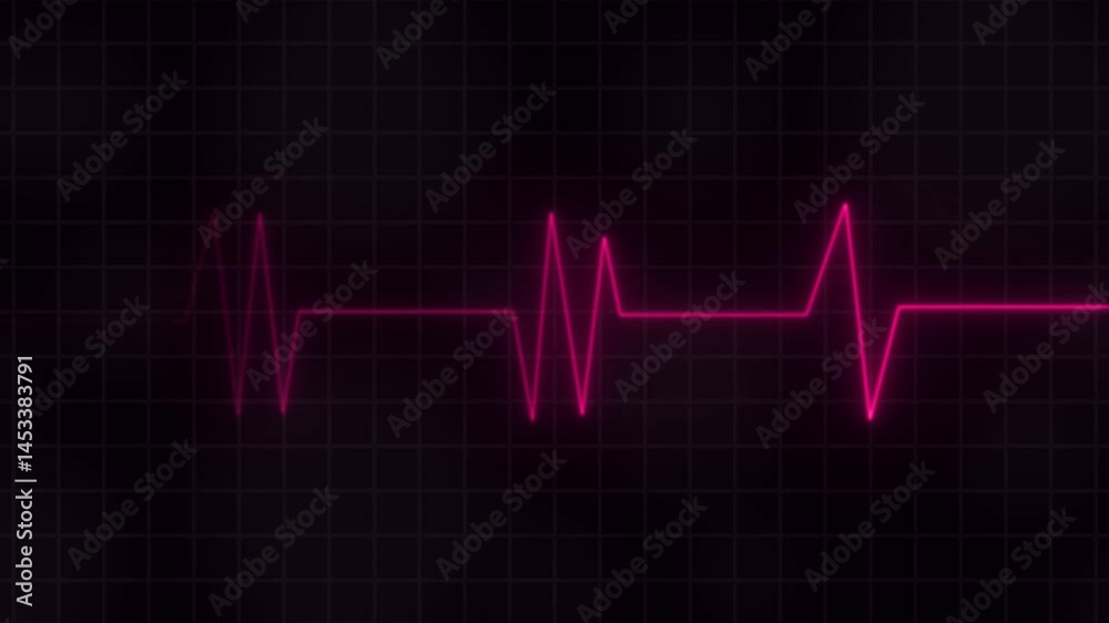 Heartbeat Monitor Animation – 4K Cardiogram Pulse Line Medical Video for Healthcare and Diagnostics. Heartbeat Monitor Animation – 4K Cardiogram Pulse Line Medical Video for Healthcare and Diagnostics.