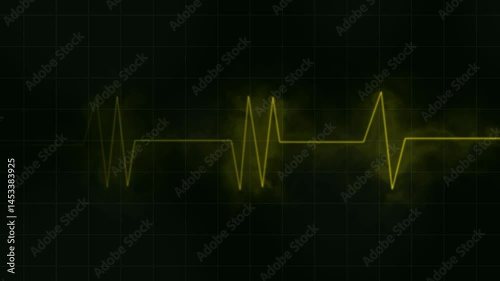 Heartbeat Monitor Animation – 4K Cardiogram Pulse Line Medical Video for Healthcare and Diagnostics. Heartbeat Monitor Animation – 4K Cardiogram Pulse Line Medical Video for Healthcare and Diagnostics.