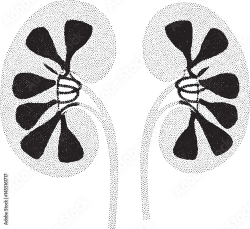Two stylized kidney illustrations display intricate internal structures against a white background.