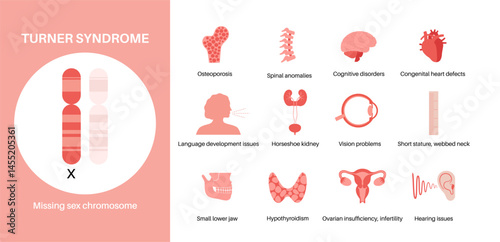 Turner syndrome poster
