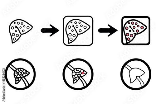 liver damage progression from fatty liver to fibrosis and cirrhosis, representing liver disease stages medical virus icon set