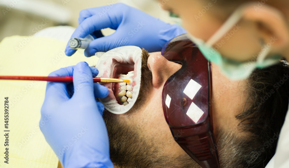 Dental expert performing whitening on teeth. Whitening session at dental office for clean teeth. Dental technology used for teeth whitening. Beautiful teeth thanks to dental whitening.