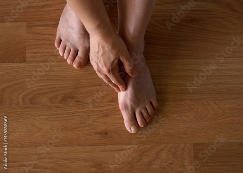 Close-up of a woman s foot with hallux valgus bunion and signs of toenail fungus. Her hand gently touches the deformed big toe, illustrating common foot problems and the need for medical care.