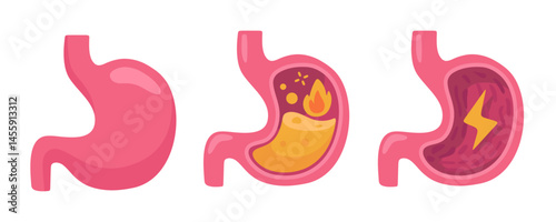 Illustrative stomach diagrams showing digestive processes